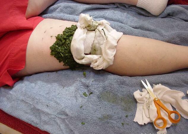 A warm poultice of crushed cabbage leaves on an arthritic knee joint