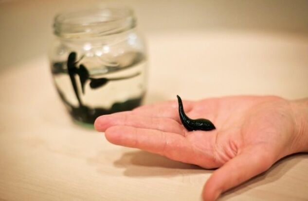 Therapeutic leeches for osteoarthritis of the knee can reduce swelling, relieve inflammation and provide anesthesia